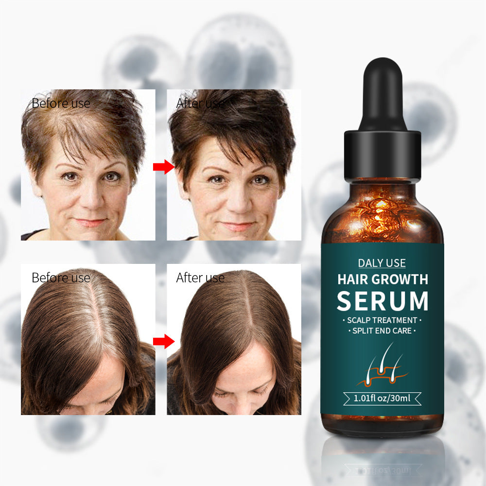 Cross-Border Best-Selling Hair Growth Serum